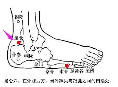 圣透灸-60昆仑穴