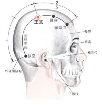 自头临泣(参见"头临泣")向上量2横指